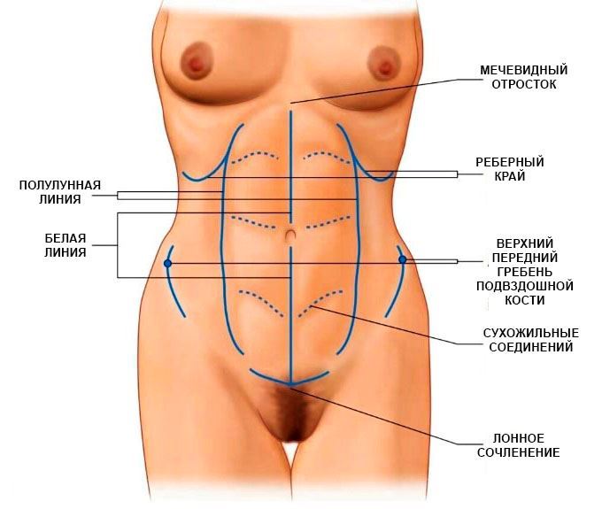 Характеристики идеального живота (Hunstad J. Atlas of Abdominoplasty, 2009, с измен.)